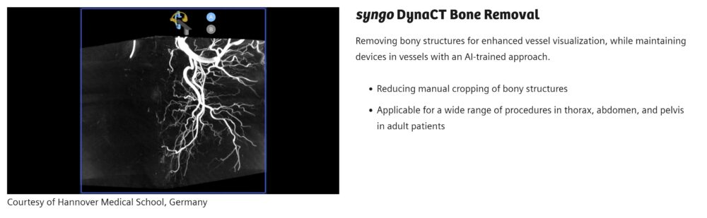 syngo dynact