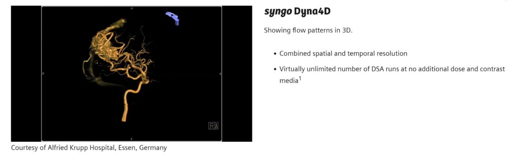 syngo dynact 4d