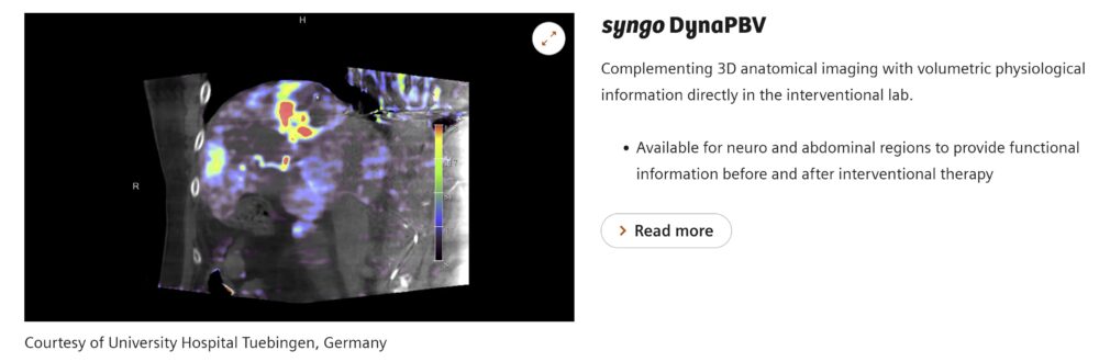 syngo dynact PBV