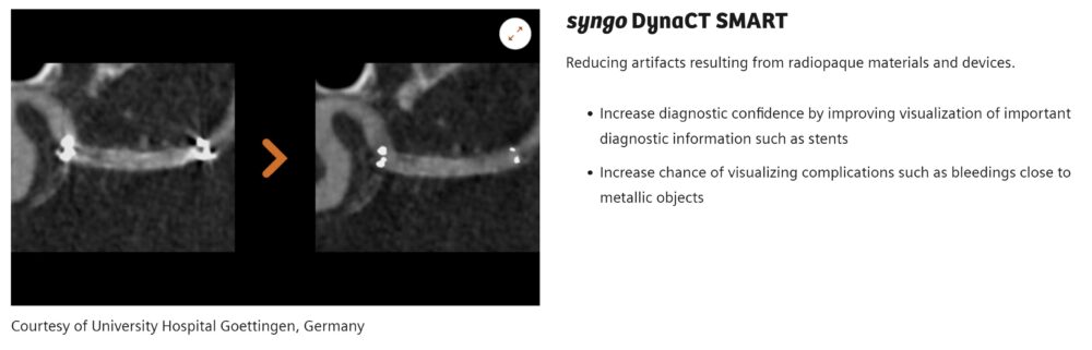 syngo dynact smart