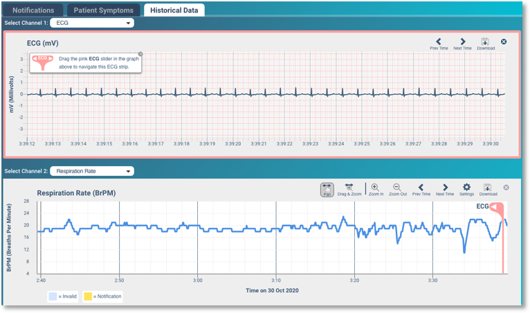 Courtesy of Vital Connect